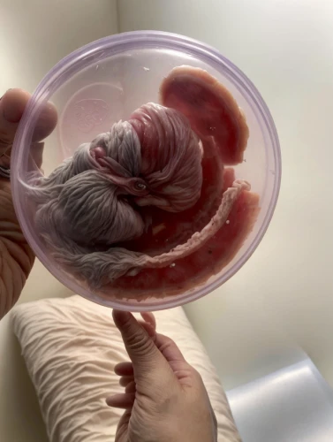 embryo,embryonic,human internal organ,obstetric ultrasonography,reflex foot kidney,kidney,newborn baby,fetus ribs,ovary,baby footprint,coronavirus disease covid-2019,human heart,connective tissue,intestines,parasite,diabetes in infant,childbirth,pregnant women,testicular cancer,biological