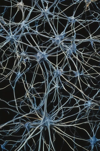 neurons,neural pathways,neural network,axons,nerve cell,synapse,neural,neurath,neurology,cerebrum,brainy,connective tissue,human brain,complexity,brain cells,brain,receptor,cognitive psychology,dopamine,networks,Photography,Black and white photography,Black and White Photography 14