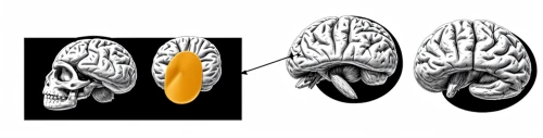 brain icon,magnetic resonance imaging,cerebrum,speech icon,brain structure,computed tomography,isolated product image,cognitive psychology,brain,axons,neurath,meiosis,medical imaging,biosamples icon,neural network,fractalius,gray icon vectors,vector images,neural,acetylcholine