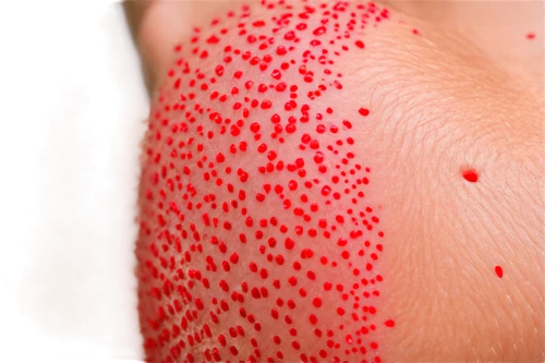 red-hot polka,trypophobia,red hot polka,polka dot pattern,dotted,coral-spot,shingles,dots,dermatology,spots,inflammation,skin texture,paint spots,corpuscle,leaf spots,dot,pin cushion,polka dot,dot pattern,polka dot paper,Conceptual Art,Sci-Fi,Sci-Fi 16