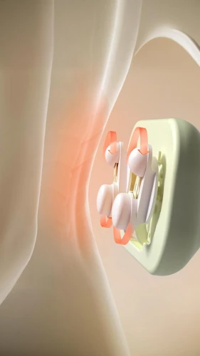 metal implants,light fractural,connective tissue,shoulder pain,magnetic resonance imaging,artificial joint,rotator cuff,accident pain,tromsurgery,medical illustration,connective back,chiropractic,cervical,homeopathically,medical radiography,gel capsule,escamol,aesculapian,softgel capsules,computed tomography