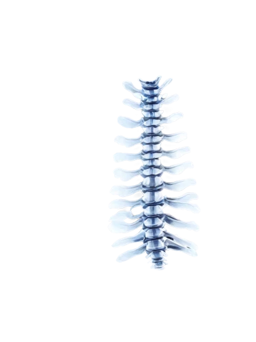 spines,spine,cervical spine,connective back,spiral bevel gears,helical,vertebrae,ribcage,spiny,centipede,rib cage,chiropractic,backbone,dna helix,palm tree vector,connective tissue,vector screw,back pain,double helix,chiropractor,Art,Artistic Painting,Artistic Painting 37