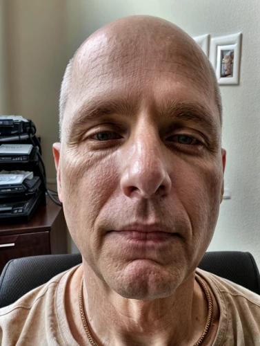 facial cancer,baldness,hair loss,17-50,shorn,physiognomy,balding,chemo therapy,management of hair loss,high and tight,middle eastern monk,nose-wise,buzz cut,chemotherapy,acupuncture,bald,full stack developer,50,elderly man,2080ti graphics card