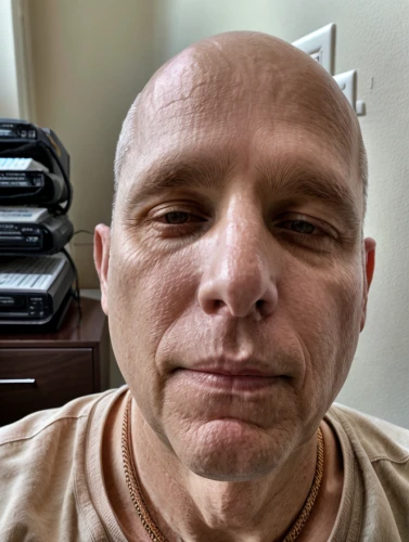 facial cancer,17-50,full stack developer,baldness,50,acupuncture,physiognomy,nose-wise,hare krishna,rock nose,hair loss,2080ti graphics card,shorn,egg face,balding,tromsurgery,chemo therapy,work at home,grill proof,middle eastern monk