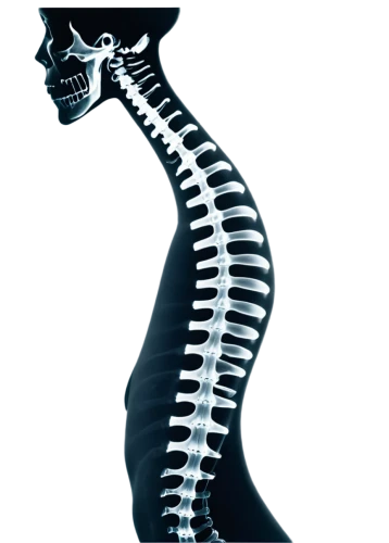 spondylitis,scoliosis,kyphosis,spinal,intervertebral,spine,connective back,osteopath,myelopathy,syringomyelia,osteoporotic,vertebral,corticospinal,cervical spine,osteopathy,vertebroplasty,back pain,musculoskeletal,lumbar,osteopaths,Photography,Documentary Photography,Documentary Photography 02