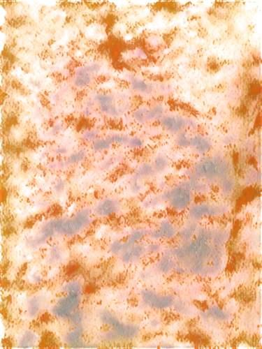 epidermis,koli bacteria,lava,enterococci,pediculosis,mesostigmata,biofilm,epidermidis,lava river,trichoderma,pintada,morgellons,epidermal,monolayer,bitumen,staphylococci,cyano,pavement,pneumococci,merozoites,Conceptual Art,Daily,Daily 32