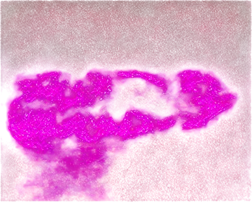 glowing red heart on railway,neon valentine hearts,cardiomyocytes,ubiquitination,microsporum,anaphase,entamoeba,hearts color pink,phosphotransferase,confocal,immunofluorescence,neutrophil,love heart,methanococcus,microvilli,phosphohydrolase,mitogen,bokeh hearts,cryptococcus,splenomegaly,Illustration,Japanese style,Japanese Style 04