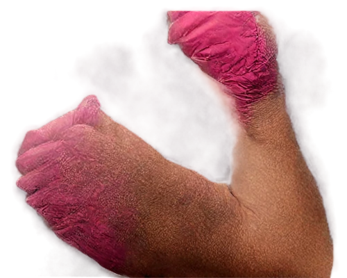 the hand of the boxer,hand digital painting,toehold,boxing gloves,kickboxing,reflex foot kidney,dermatomyositis,hyperkeratosis,pugilistica,kushti,lymphedema,muaythai,hemangiomas,polydactyly,foot model,southpaw,barehand,keratoderma,dermatosis,pugilist,Conceptual Art,Sci-Fi,Sci-Fi 20