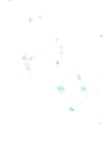 neurospora,autoradiography,reionization,ngc 2818,isolated product image,ngc 6523,diplopia,koli bacteria,ngc 2070,psittacosis,chondrules,mesostigmata,entamoeba,messier 8,ngc 6543,microglia,ngc 7635,ngc 2082,ngc 6537,neurodegeneration,Photography,Documentary Photography,Documentary Photography 10