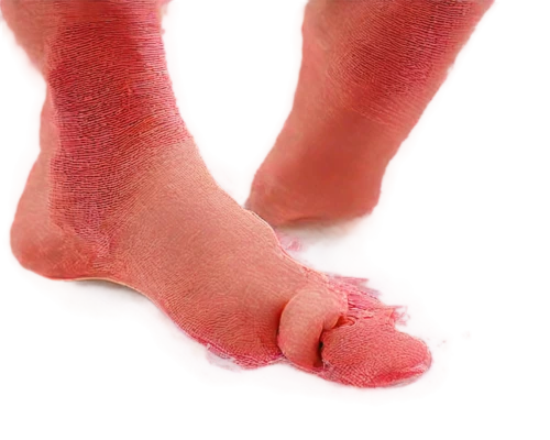 foot model,toe,neuroma,foot,lymphedema,polyneuropathy,the foot,reflex foot kidney,foot reflexology,reflex foot esophagus,reflex foot sigmoid,metatarsal,foot reflex,hindfeet,neuropathy,footsore,hindfoot,podiatry,onychomycosis,edema,Conceptual Art,Fantasy,Fantasy 14