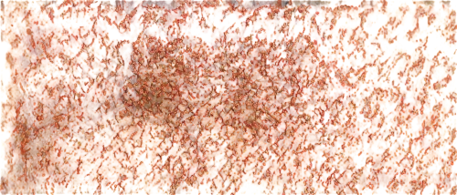 melanoma,premaxillae,magma,mozote,degenerative,molten,lava,fur,angioma,orang,varroa,melanomas,epidermis,menegazzia,epidermal,fractalius,epidermidis,xxxvii,ant,monolayer,Illustration,Realistic Fantasy,Realistic Fantasy 10