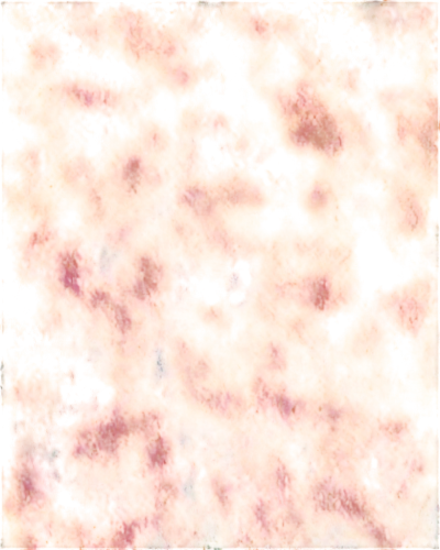 biofilm,monolayer,petromatrix,neurospora,biofilms,seamless texture,nanorods,epidermidis,microlensing,reionization,bilayer,koli bacteria,autoradiography,enterococci,diplopia,isolated product image,angioma,meditrust,aquaporin,angiomas,Photography,Fashion Photography,Fashion Photography 01