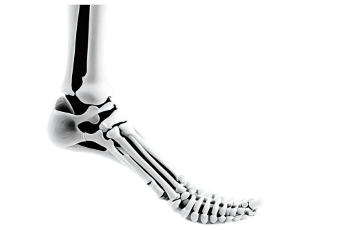 ulna,leg bone,tibia,osteopenia,artificial joint,metatarsus,sesamoid,osteological,femur,skeletal,metacarpals,metatarsal,forelimb,metacarpal,fibula,metatarsals,skeleton,thighbone,osteoporotic,osteomalacia,Illustration,Abstract Fantasy,Abstract Fantasy 15