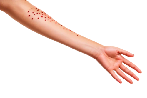 dermatomyositis,keratosis,epidermal,psoriasis,epidermolysis,mesodermal,melanomas,dermatosis,pityriasis,scuticaria,papules,keratoderma,dermatologic,mesostigmata,epidermis,cutaneous,folliculitis,hyperkeratosis,polyarthritis,membranacea,Illustration,Paper based,Paper Based 07