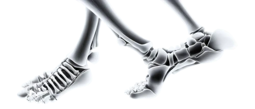 hindfeet,forelimb,thighbone,metatarsals,ulna,hindlimbs,hindlimb,leg bone,navicular,osteopenia,reflex foot sigmoid,sesamoid,metatarsal,ligamentous,metacarpals,dorsiflexion,ligamentum,osteological,metatarsus,femurs,Photography,Documentary Photography,Documentary Photography 11