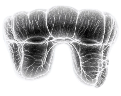 radiograph,radiographs,micromolar,x-ray of the jaw,tendinous,mylohyoid,mediastinum,pericoronitis,fluorosis,pulpitis,dentary,periapical,tuberosity,calcifications,intramuscular,sacroiliac,occlusal,plethysmograph,molar,angiograms,Illustration,Abstract Fantasy,Abstract Fantasy 08