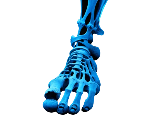 osteoporotic,orthopedics,artificial joint,osteoarthritis,osseointegration,ulna,musculoskeletal,osteoporosis,metacarpal,osteopath,osteopathy,skeletal,osteocalcin,metatarsus,osteopathic,metacarpals,arthritis,hindlimb,forelimb,orthopedist,Conceptual Art,Fantasy,Fantasy 11