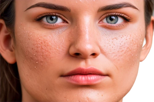 rosacea,hyperpigmentation,skin texture,depigmentation,keratosis,beauty face skin,healthy skin,natural cosmetic,collagen,dermatologic,pigmentation,epidermis,woman's face,microdermabrasion,epidermal,procollagen,moistureloc,pores,dermatological,dewy,Photography,Documentary Photography,Documentary Photography 25