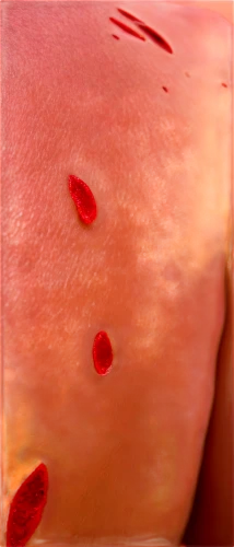 hemangiomas,hematomas,mesostigmata,angiomas,eosinophilia,melanomas,hemangioma,adenomas,pediculosis,pityriasis,stoma,xanthomonas,hypovolemia,leukocytes,melanoma,varicella,cryptosporidiosis,angioma,epidermolysis,haematoma,Illustration,Realistic Fantasy,Realistic Fantasy 34