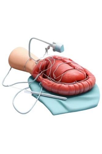 medical illustration,endocardial,medical concept poster,paraventricular,defibrillation,atrioventricular,subventricular,cardiology,microcirculation,electrocardiography,coronary artery,cardiovascular,supraventricular,coronary vascular,cardioverter,cardiac massage,electrocardiogram,cardiological,cardiopulmonary,cardioversion,Conceptual Art,Daily,Daily 29