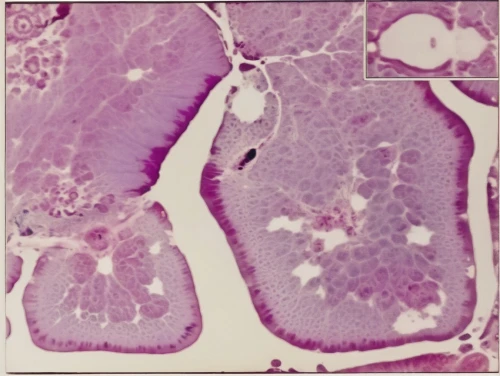 cryptosporidiosis,juxtaglomerular,megakaryocytes,sporocysts,meningioma,cheilocystidia,oligodendrocyte,histopathological,keratinocytes,telangiectasia,parmeliaceae,chenopodiaceae,dorsoventrally,connective tissue,hypovolemia,ectomycorrhizal,coccidioidomycosis,rhizoctonia,mycorrhizae,neurospora,Photography,General,Realistic