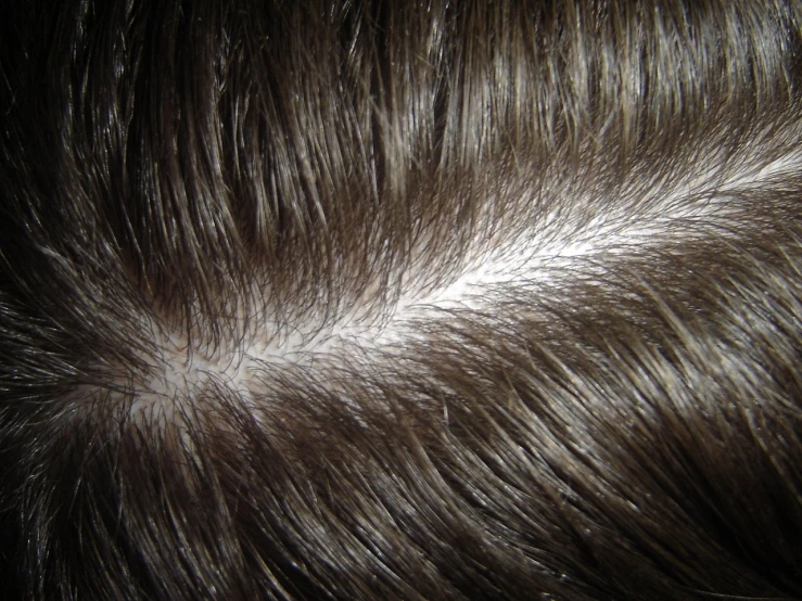 white lines of hair that looks like some kind of substance