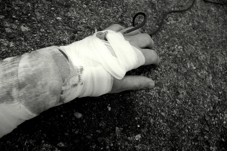 an injured person holds the thumb of their hand