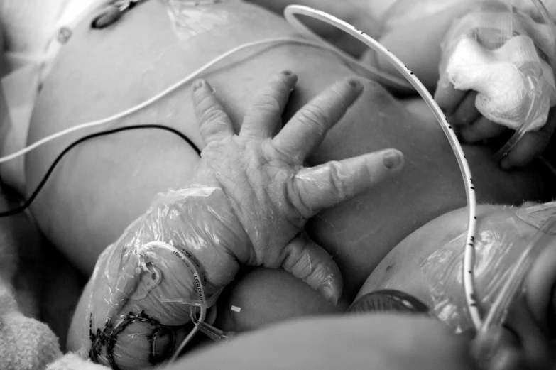 a baby sleeping while being vaccinated on its back