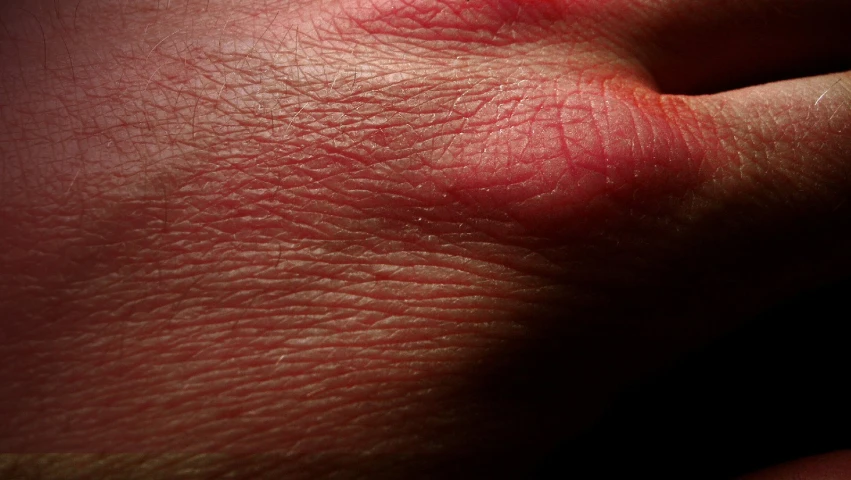 the arm and shoulder of a person with red spots on it