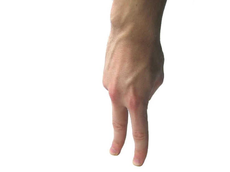 a hand reaching up with the thumb in the air