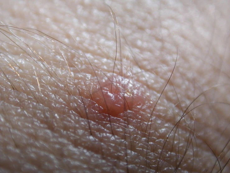 small and thin circular shaped hair on the skin of a person