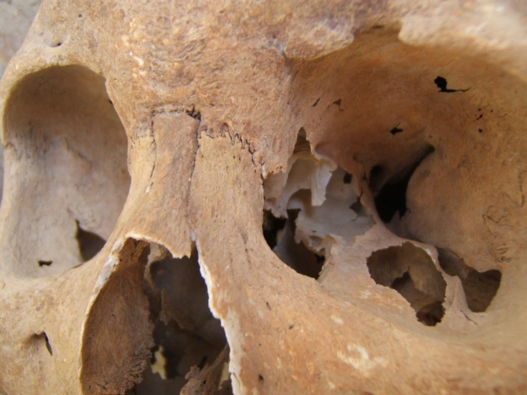 a bone with holes that is missing or has been split up