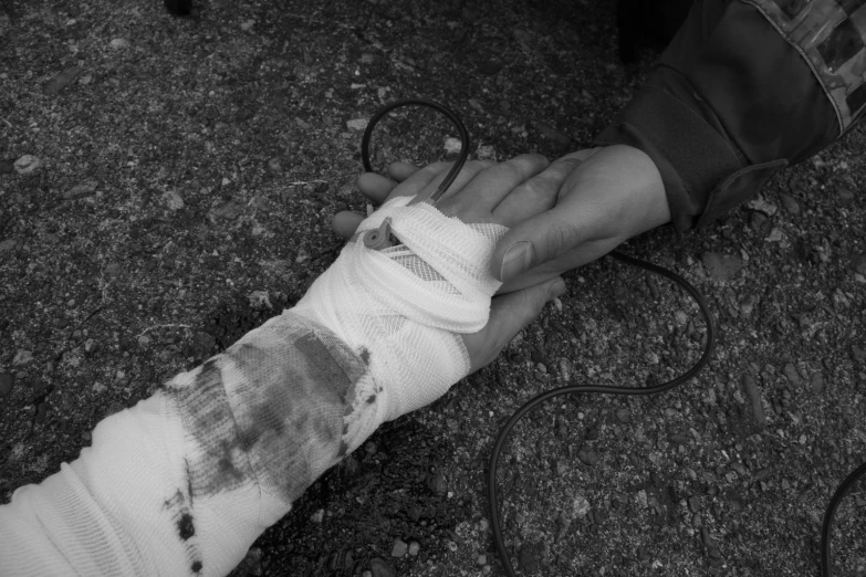 a broken arm that has been placed in someone's hand