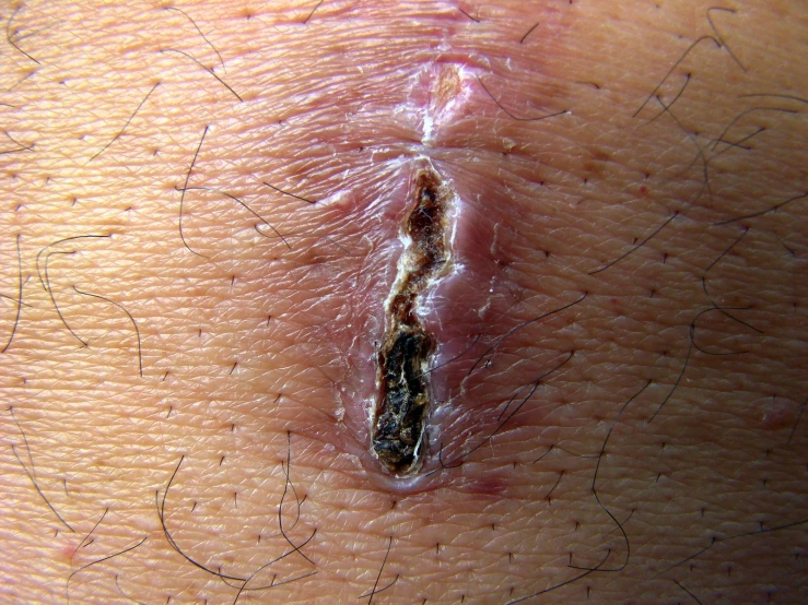 close up of a small insect in the skin