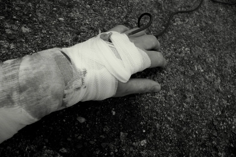 a person with a injured hand and an iv