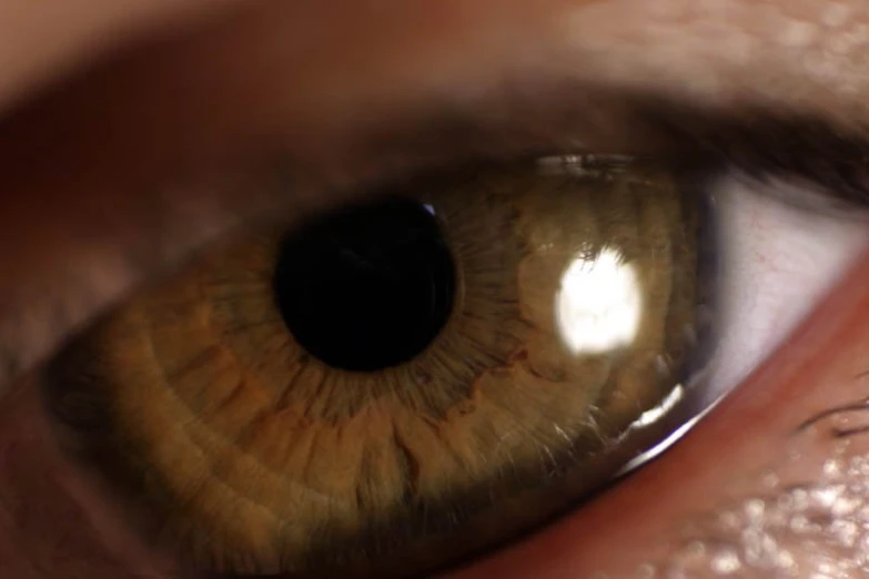 a closeup of a persons yellow eye