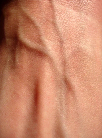 closeup of arm that has the light shining on it