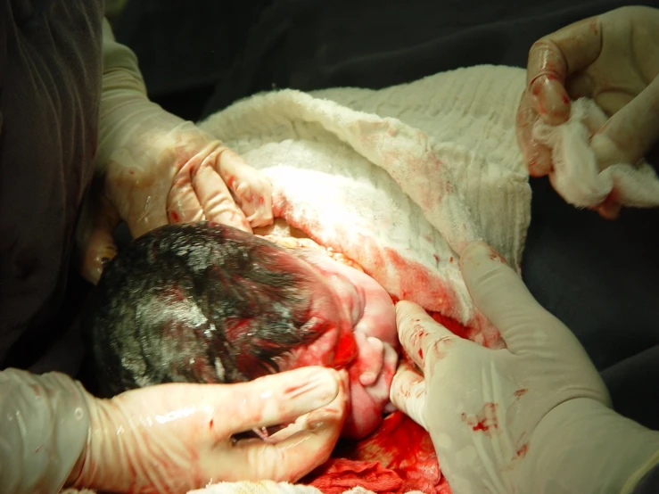 a person with y hands holding a bird