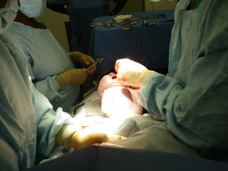 three doctors looking at a baby being screened for 