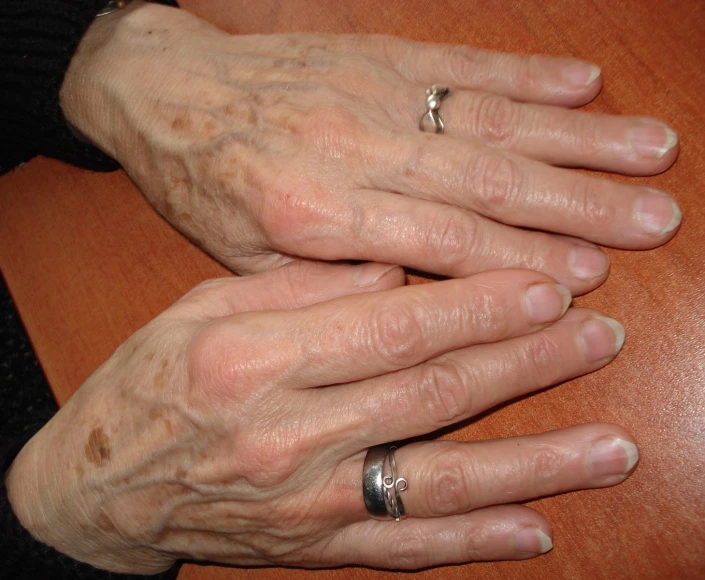 two people holding hands with dirty fingers on them