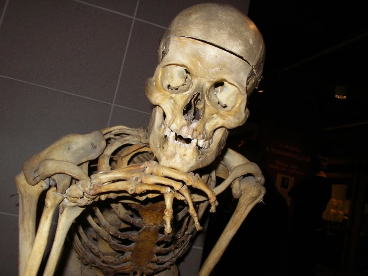 an old skeleton with its hand resting on the skull