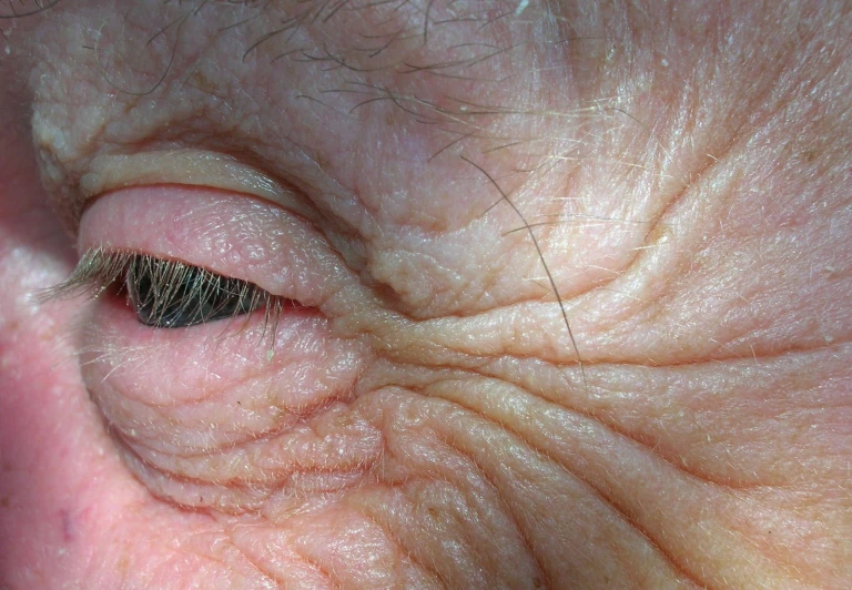 a person's eye with brown, fuzzy hair and white spots