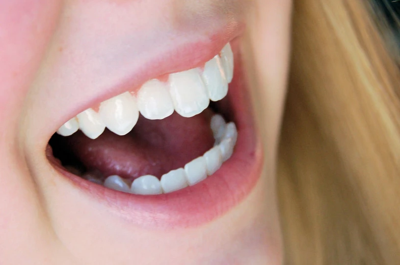 woman with teeth exposed and tongue visible