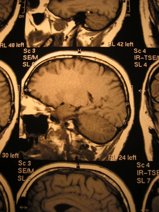 an x - ray of the in showing multiple parts of the in