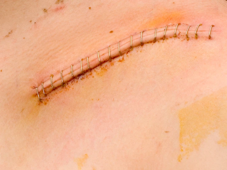 an upper part of the stomach with hair on it
