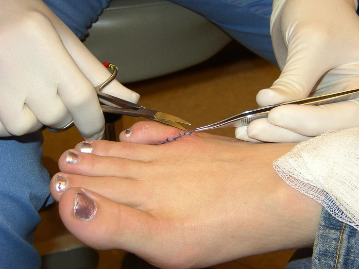 someone is getting their nails done by someone wearing white gloves