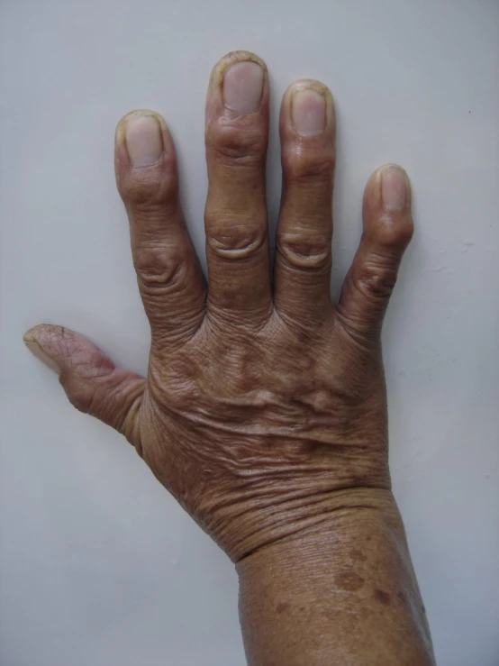 an image of a very large hand with very thick fingers