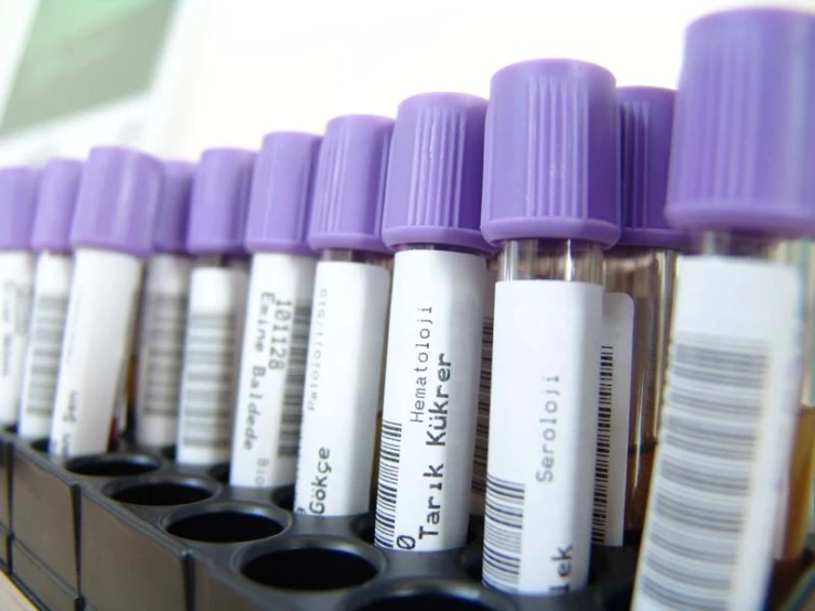 a row of test tubes filled with purple liquids