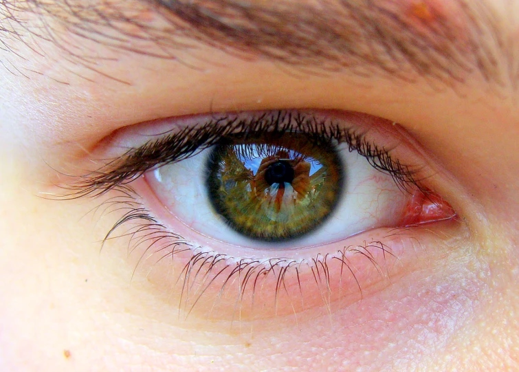 green and white eye and iris of a persons blue eye