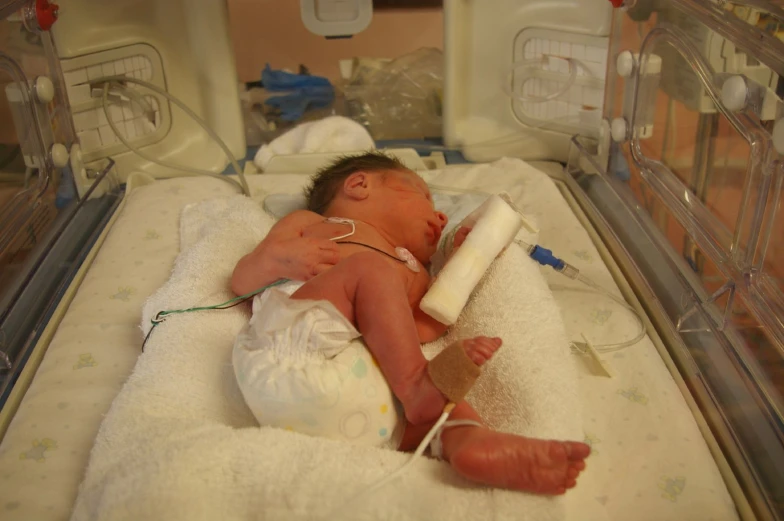 a baby laying down in a inclosure and using a sprinkle to treat a tube of ivu